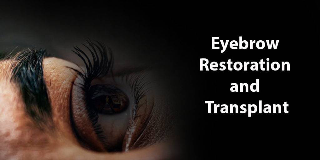 Eyebrow Transplant Malaysia