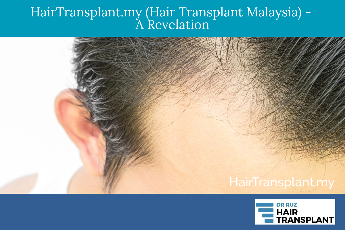 Hairtransplantmy Hair Transplant Malaysia A Revelation Hair Transplant Malaysia 9173