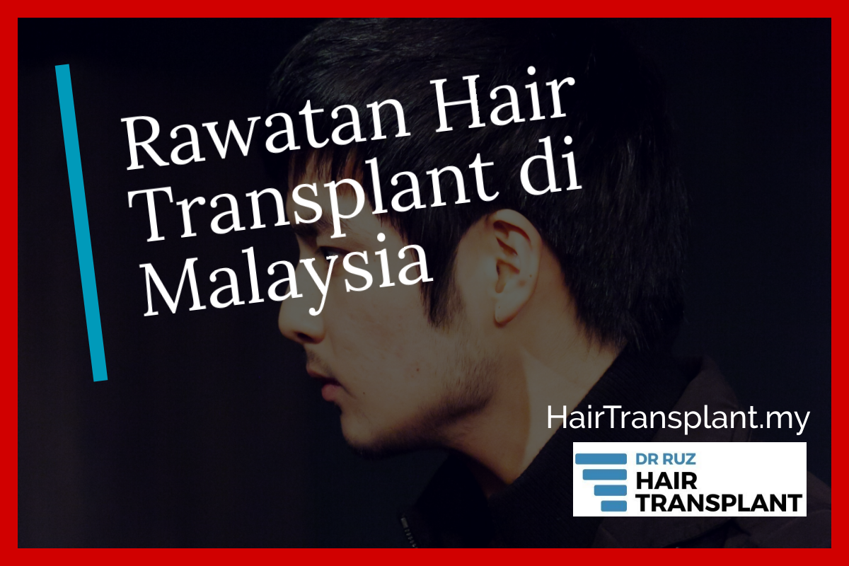 Rawatan Hair Transplant di Malaysia