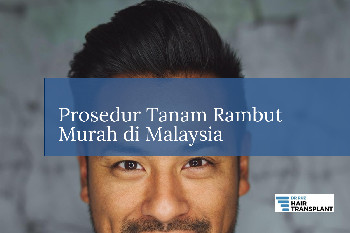 Prosedur Tanam Rambut Murah Di Malaysia