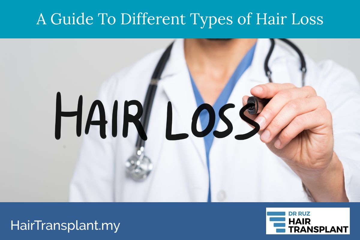 A Guide To Different Types Of Hair Loss A Guide To Different Types Of Hair Loss
